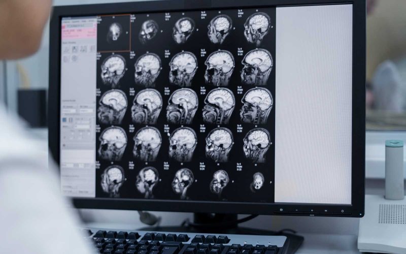 doctor-looking-ct-scan