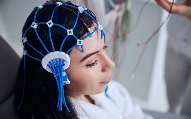 eletroencefalo
